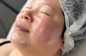 woman with glowing skin