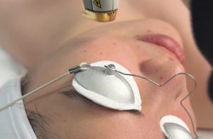 Woman receiving Laser Genesis