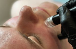 man receiving hydrofacial treatment