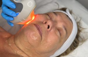 Woman receiving Skin Tightening